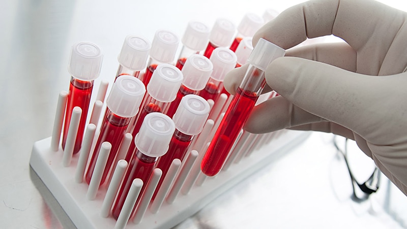PHÒNG XÉT NGHIỆM TÂM ĐỨC LAB